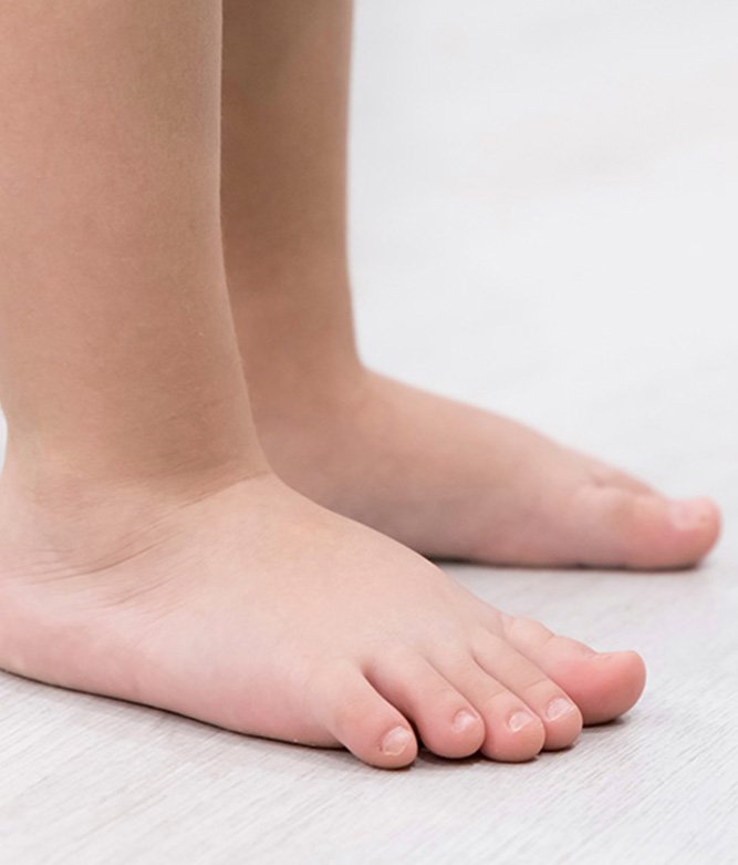 flat feet kids